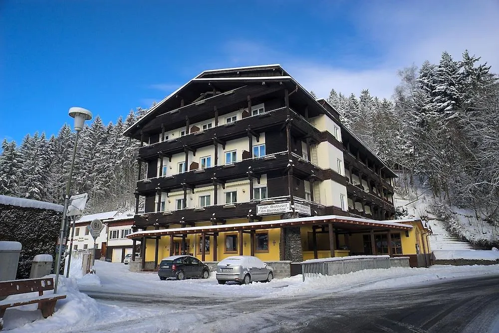 Hotel Natur- und Wanderhotel am Steinbachtal Kötzting